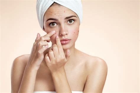 Девушка с прыщами. Косметика от прыщей на лице | Beauty skin care, Skin ...