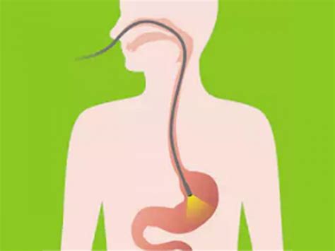 5 Steps to Efficiently Prepare for a Gastroscopy Procedure