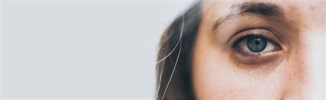 ultimate cheek enhancement euderm skin  hair clinic