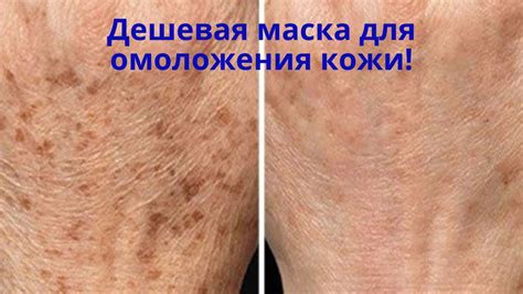 Домашняя карбокситерапия! Шикарная копеечная маска для лица 2 в 1 ...