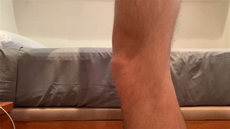 Tendon crossing bone in the left knee? WTF? (more in first comment) : r