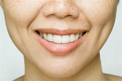 botox   wide nose  surgical nose job