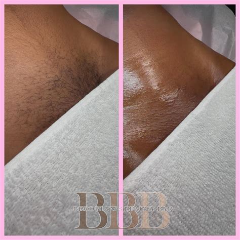 Brooklyn's - Before & After Brazilian Wax Transformation! Let’s talk