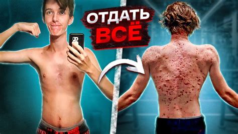 Дрищ сел на химию и ЖУТКО СГНИЛ НА ГЛАЗАХ У ВСЕХ - YouTube