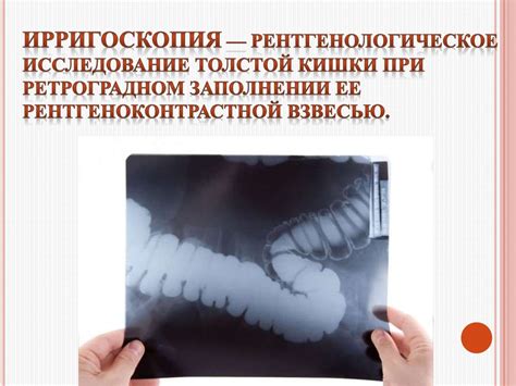 Эндоскопические методы исследования кишечника - online presentation