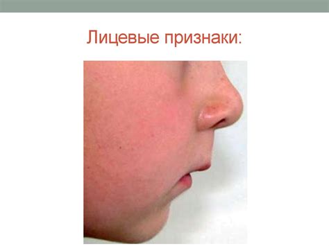 Прикусы. Виды патологических прикусов - презентация онлайн