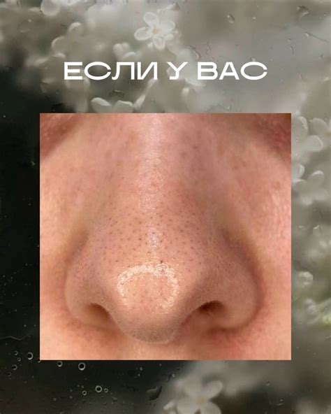 Vi Estetic • Массаж лица • Спа • Питер | Поможем вам быть красивой и ...