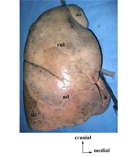 azygos vein lung hilum