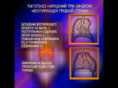 Повреждения грудной клетки и органов грудной полости - презентация онлайн