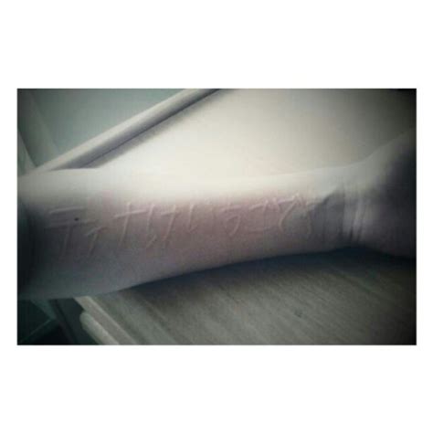 dermographism on Tumblr