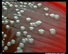 Morganella Morganii: Symptoms, Diagnosis and Treatment - Symptoma®