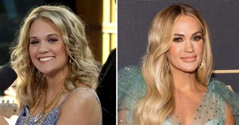 Carrie Underwood Plastic Surgery: A Detailed Analysis