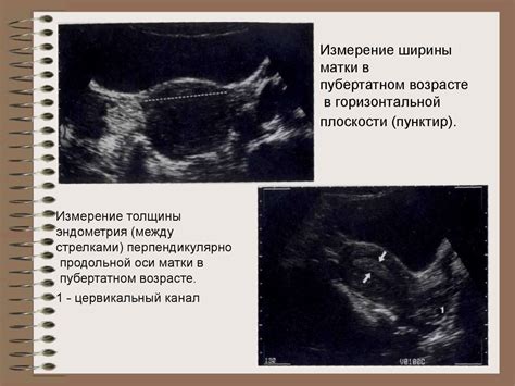 Детская гинекология - презентация онлайн