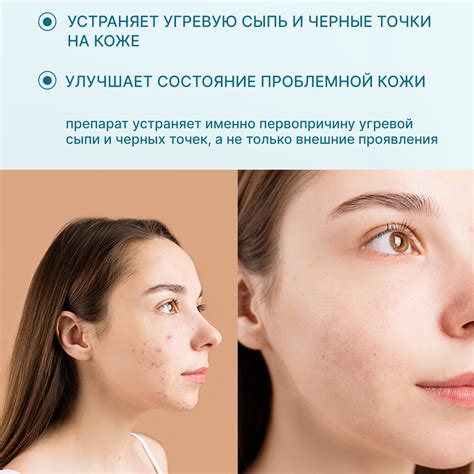 Набор Green Leaf Formula Таблетки от прыщей и Коллаген для кожи и волос ...
