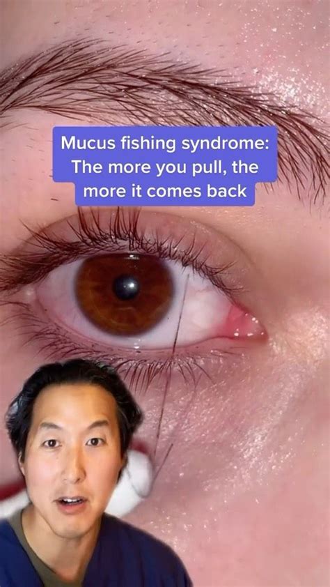 Watch this reel by tonyyounmd on Instagram