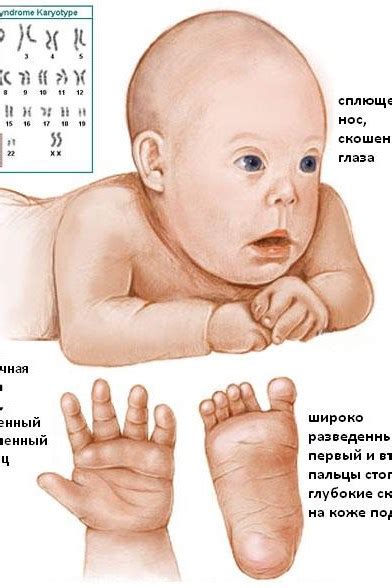 Давайте не будем искать у эмбрионов синдром Дауна! © / Новости общества ...