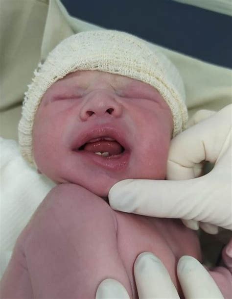 Bebê Nasce Com Dentes - Bebê nasce com dois dentes e surpreende família paranaense: 'Nosso bebê ...