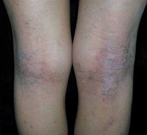 Common Skin Disorders | Basicmedical Key