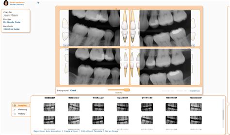 Curve Dental Imaging Software: Enhanced Clarity & Workflow