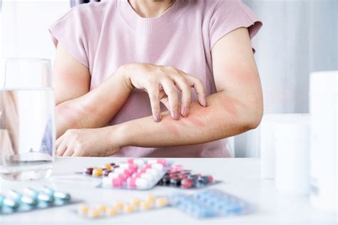 Alergi obat - O2 Healthcare Group