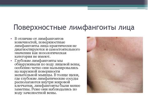 Лимфаденит - презентация онлайн