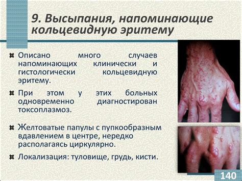 Кожные проявления ВИЧ-инфекции - презентация онлайн