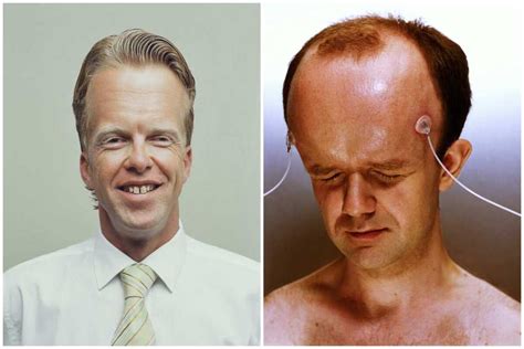 biggest forehead   world unveiling unique features