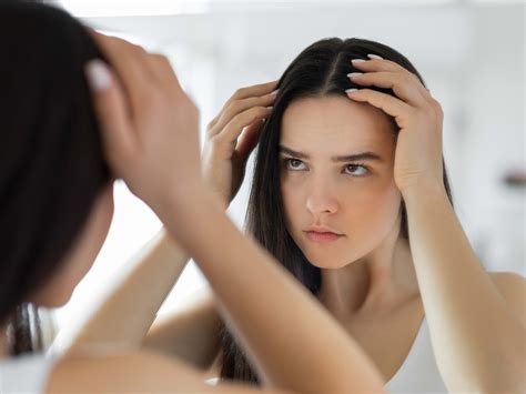 Hives On Scalp And Forehead - Infoupdate.org