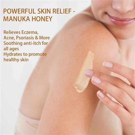 Manuka Eczema Eczema Cream, Hand Foot Psoriasis Philippines | Ubuy