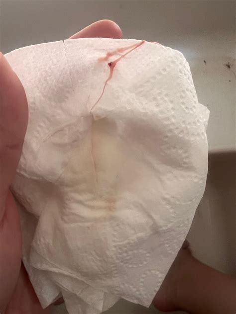 TMI Warning: Pink stringy discharge/6 weeks pregnant | BabyCenter