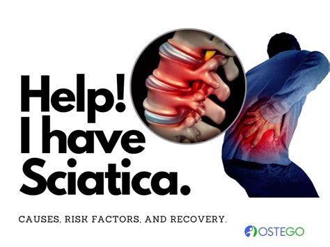 sciatica    risk factors
