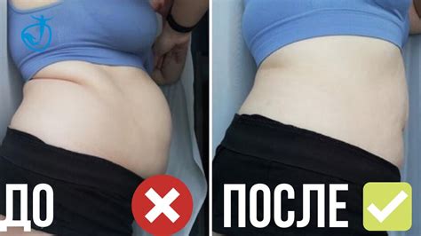 БАНДАЖ ДЛЯ БЕРЕМЕННЫХ И ЖИВОТ ПОСЛЕ РОДОВ // Животам НЕТ - YouTube