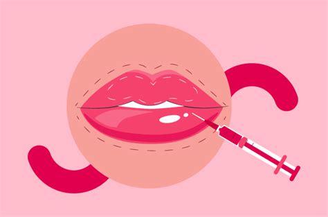 filler wajah tujuan jenis  prosedur halodoc