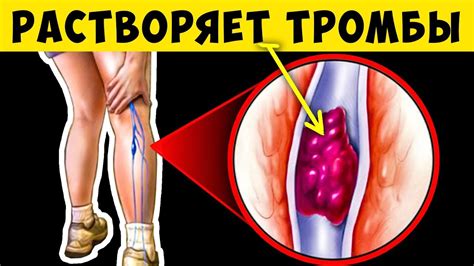 Эти 15 продуктов рекомендуют Флебологи для Растворения Тромбов в ...