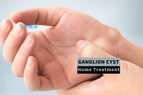 ganglion cyst ankle home treatment    rid  ganglion cysts