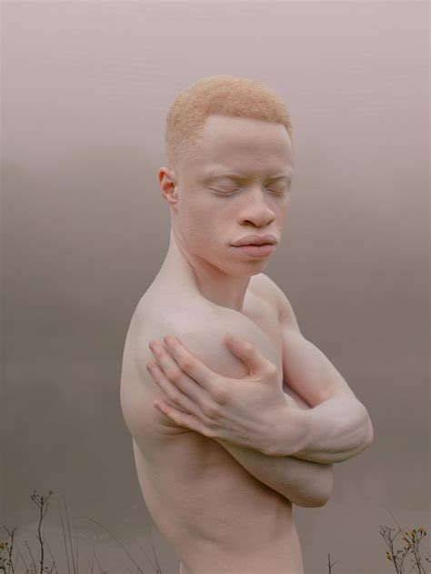 279 best Albino images on Pinterest
