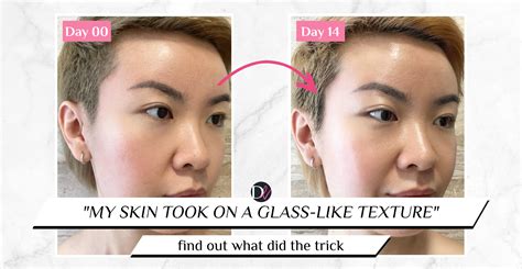 Vegreen Fragrance-Free Cica Serum review (2 week trial!)