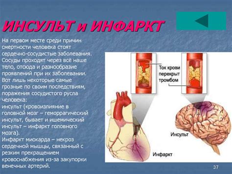 Сердце. Строение сердца - презентация онлайн