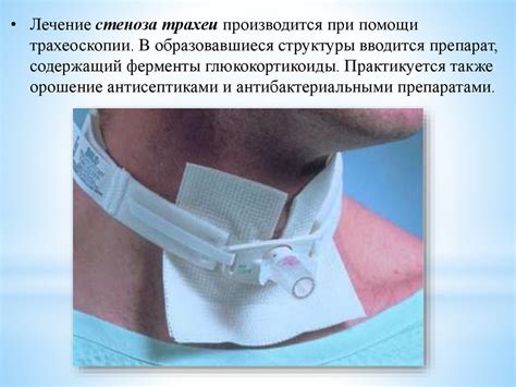 Трахеостома. Трахеостомическая трубка - презентация онлайн