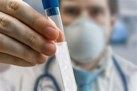 Сгустки в семенной жидкости: виды комочков, причины, норма это или нет ...