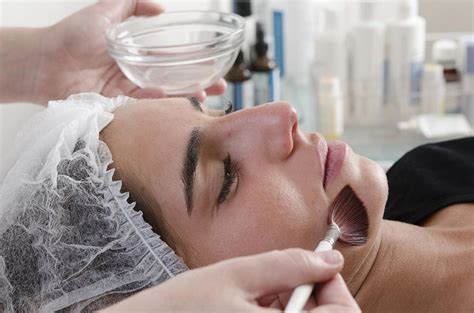 tratamiento Peeling Químico – medicalskincenter