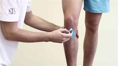 Разрыв крестообразных связок колена: частичный разрыв передней ...