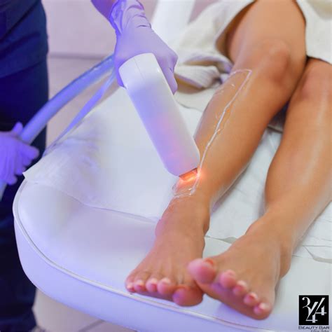 laser hair removal - munimoro.gob.pe