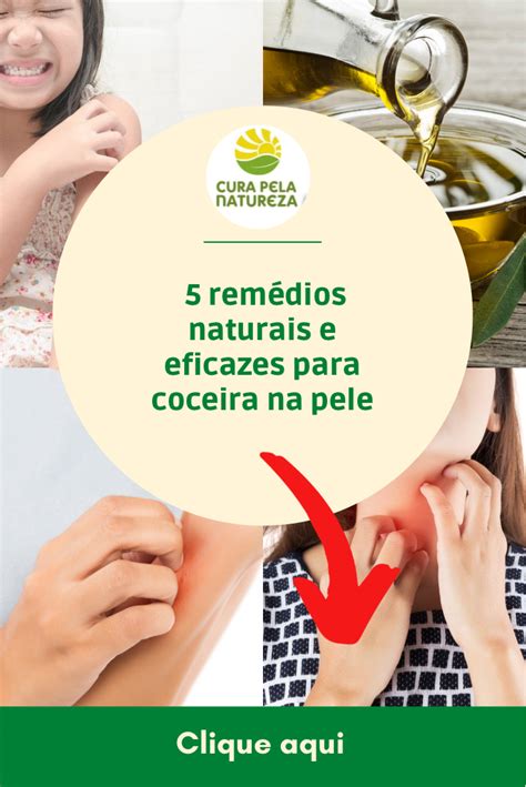 O Que É Bom Para Coceira Na Pele