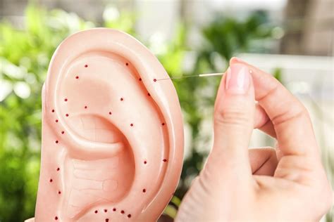 Auriculoterapia O Que É - O que é Auriculoterapia? Quais seus Benefícios para a Saúde!