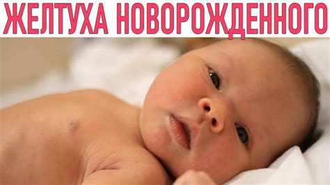 ЖЕЛТУХА У НОВОРОЖДЕННОГО РЕБЕНКА | Желтуха у ребенка причины и ...
