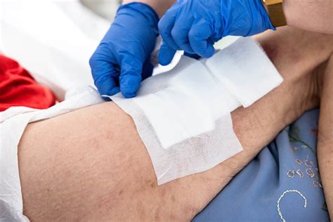 foam dressings medisave uk