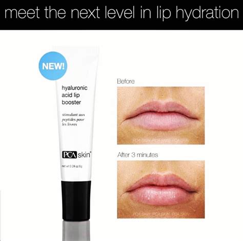 Beautiful, moist , plump lips! – Beleza Salon Roswell