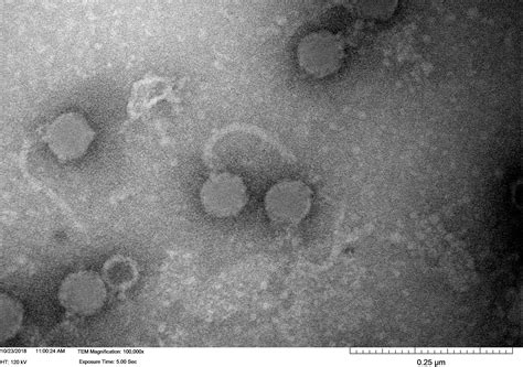 The Actinobacteriophage Database | Phage Lupine