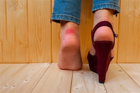 Что делать, если обувь сильно натирает ногу? Советы о том, как ...